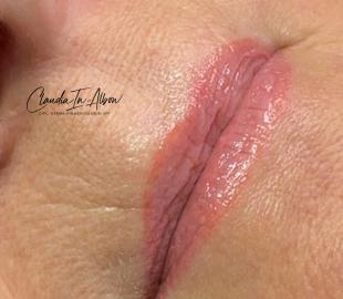 Abgeheilt nach einer Behandlung